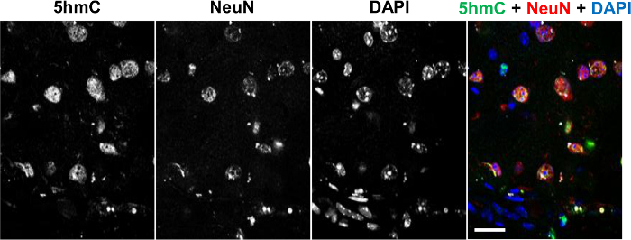 figure-results-1 Immunofluorescence microscopy showing 5hmC, NeuN, DAPI staining in neural cells; overlay included.