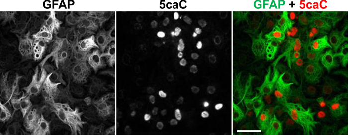 figure-results-2 GFAP and 5caC immunofluorescence microscopy, protein and epigenetic marker analysis, cell imaging.