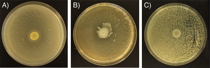 Petri dish analysis of bacterial growth inhibition; zones of inhibition; microbial resistance test.