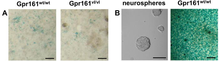 Microscopy image comparing Gpr161 gene expression in wild-type vs mutant neurospheres.