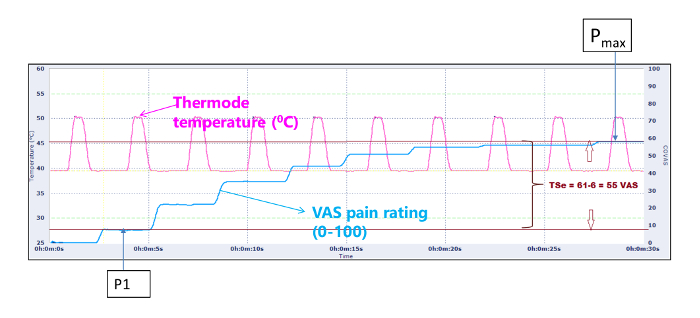 Thermal pain response graph; thermode temperature, VAS rating analysis over time.