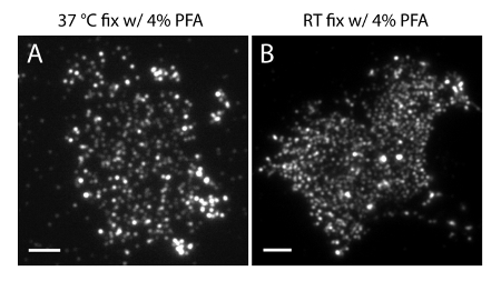 Fluorescence microscopy of cells; 37°C vs RT fixation with 4% PFA; cellular protein localization.