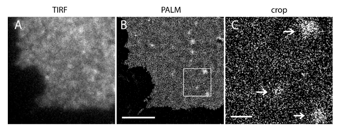TIRF and PALM microscopy images detailing cellular structure at high resolution; crop shows detail.
