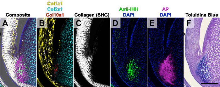 figure-results-4 Cartilage tissue imaging; RNA fluorescence, collagen, anti-IHH, AP staining; microscopy results.