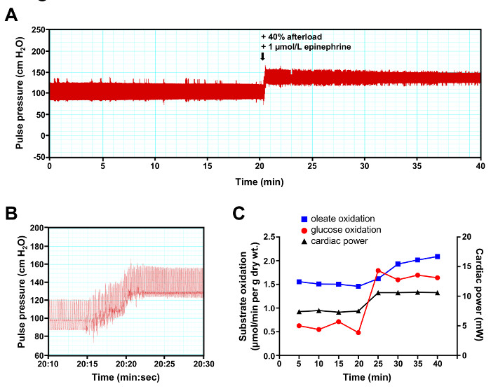 Cardiac function graphs: pulse pressure, substrate oxidation, cardiac power changes with epinephrine.