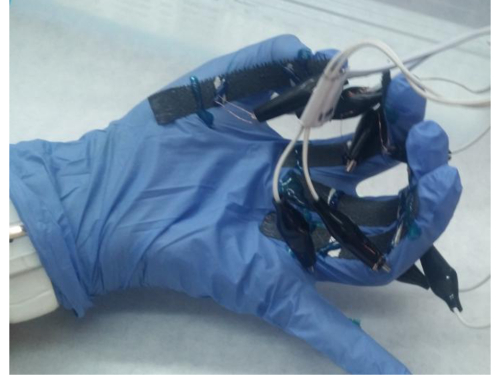 Gloved hand with electrode setup for biosignal recording, wearable health technology experiment.