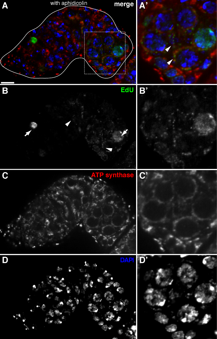 Cell imaging analysis, aphidicolin effect on EdU, ATP synthase, DAPI-stained cells; microscopy diagram.