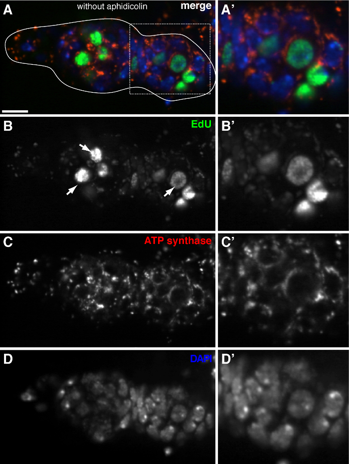 Fluorescence microscopy of cell nuclei with EdU, ATP synthase, DAPI staining; cellular analysis.