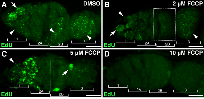 EdU fluorescence microscopy; mitochondrial membrane potential effect with varying FCCP concentrations.