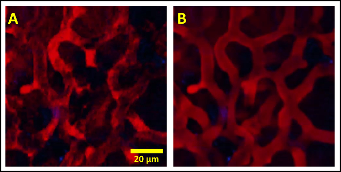 Long-term High-Resolution Intravital Microscopy in the Lung with a ...