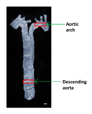 Aorta anatomy labeled diagram; aortic arch and descending aorta highlighted for educational use.