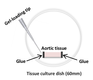 Aortic tissue setup in 60mm dish; diagram with gel-loading tip and glue; tissue culture method.