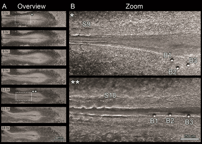 figure-results-2 Time-lapse microscopy showing wound healing over 18 hours, with detailed zoom at 0 and 12 hours.