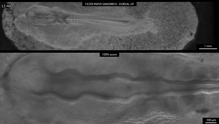 figure-results-7 Zebrafish embryo development under microscope; two magnification levels; 100% zoom detail.