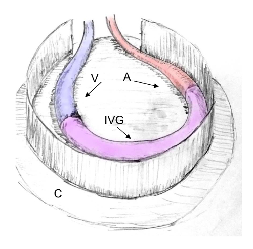 Vessel cross-section diagram; blood flow in circulatory system: artery (A), vein (V), vessels (IVG).