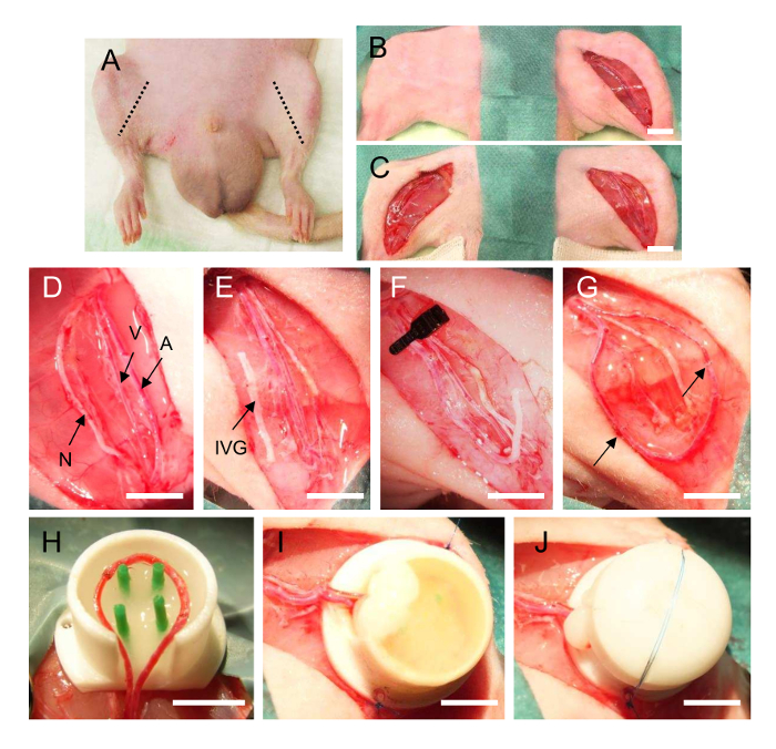 Surgical procedure diagram; nerve, vein, artery isolation; implanted vascular graft; transplantation method.