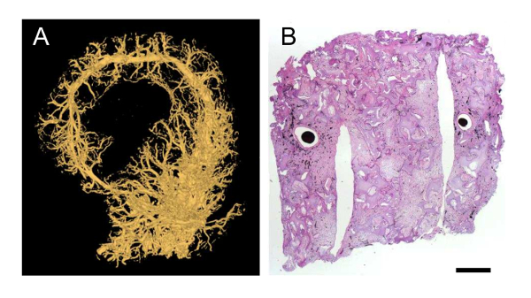 CT scan and histological section of bone structure; diagram showing morphological analysis.