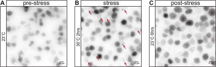 Cellular stress effects; microscopy images of cells pre-stress, stress, and post-stress conditions.