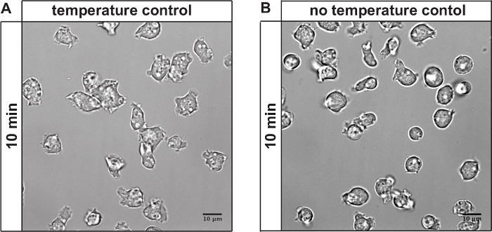 Cell morphology comparison; microscopy image; temperature control vs. no control; 10 min exposure.