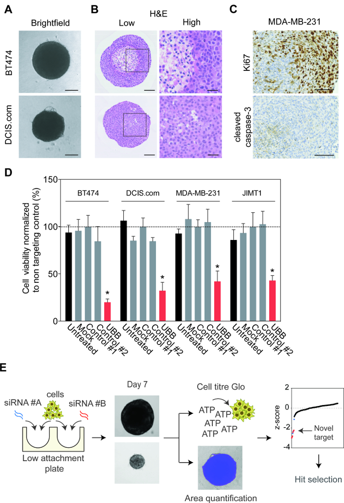 figure-results-1 Cell viability assay results with siRNA treatment on cancer cell lines; includes brightfield, H&E stains, immunohistochemistry, and bar chart analysis.