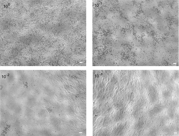 Zika Virus Infectious Cell Culture System and the In Vitro Prophylactic ...