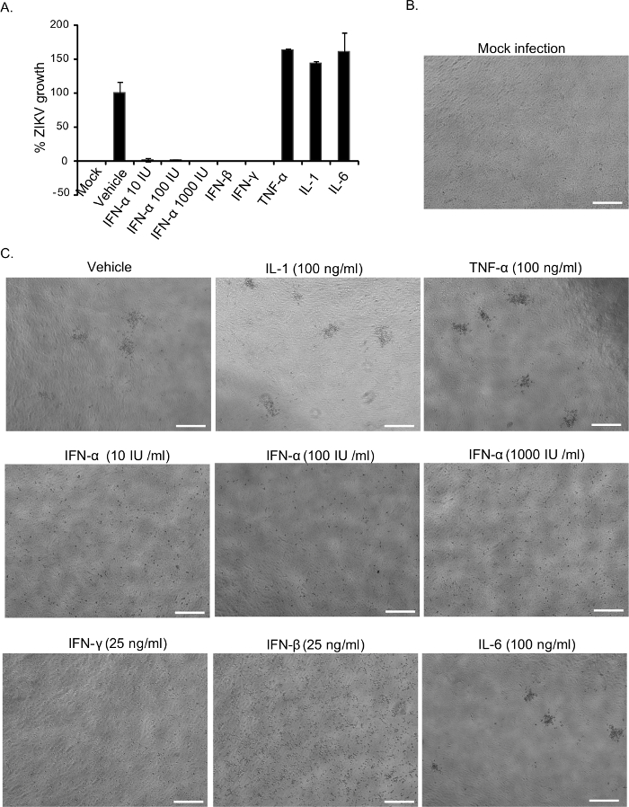 Zika Virus Infectious Cell Culture System and the In Vitro Prophylactic ...