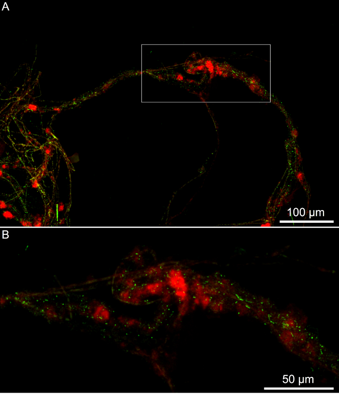 figure-results-4 Confocal microscopy image of neuronal network with fluorescent markers, scale bars 100μm and 50μm.