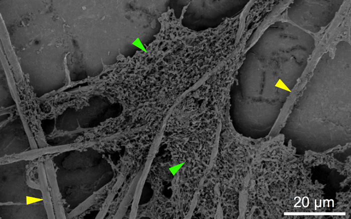 figure-results-5 SEM image of biofilm structure on a surface, highlighting intricate bacterial network with scale bar.
