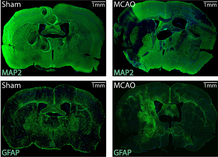 figure-results-3 Brain tissue immunofluorescence microscopy images; MAP2, GFAP markers; sham vs. MCAO conditions.