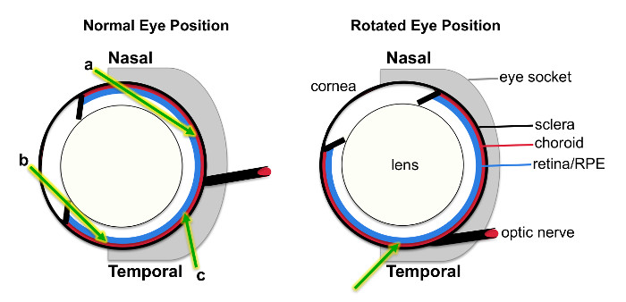 Eye anatomy diagram; normal vs rotated position, displaying nasal-temporal movement, sclera, lens.