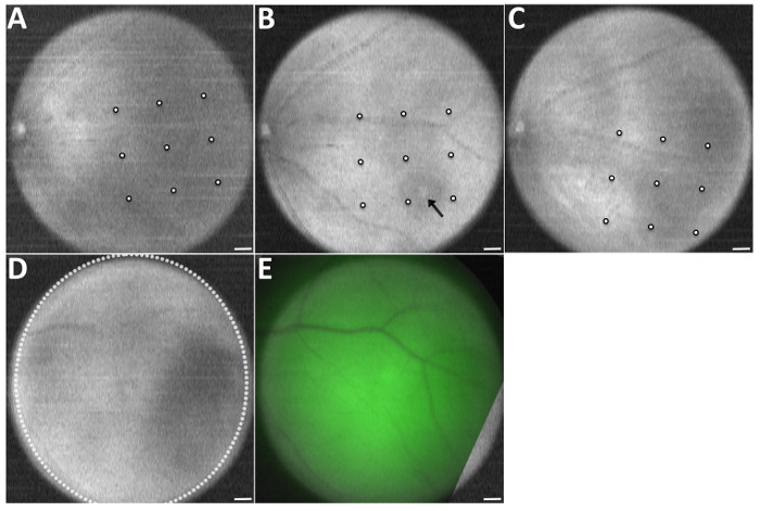 Fundus imaging; grayscale and fluorescent retinal angiography; medical diagnostic analysis.