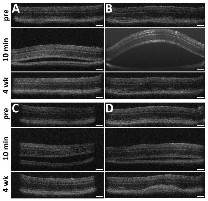 OCT retinal layers over time; pre, 10 min, 4 weeks post-experiment; time-lapse analysis diagram.
