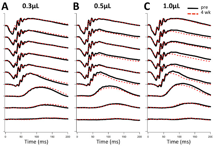 Transient absorption spectroscopy results; graphs show pre and 4-week data at 0.3, 0.5, 1.0 μL.