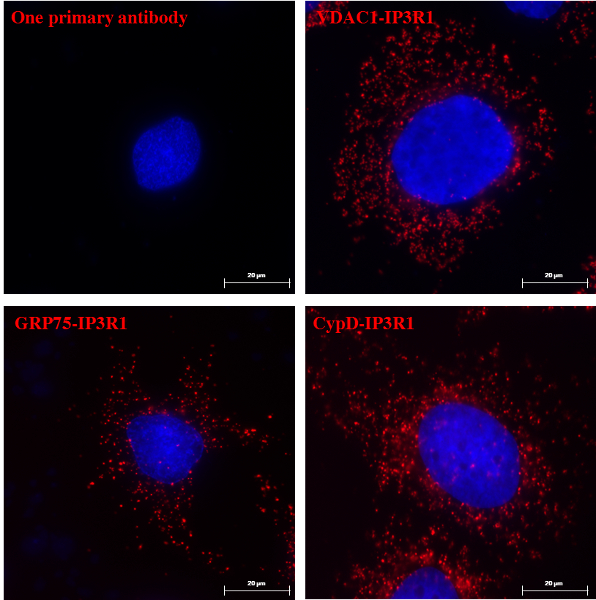 Fluorescence microscopy of IP3R1 interactions; red shows antibody staining, cell structure in blue.