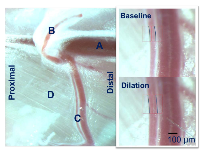 Heart valve anatomy diagram, dilation vs baseline microscopy comparison, vessel cross-section.