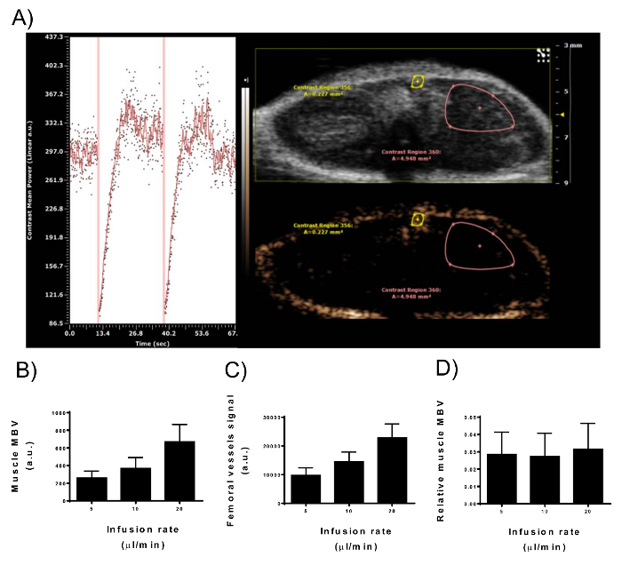 Ultrasound imaging with contrast agent showing infusion rates and signal graphs for muscle perfusion.
