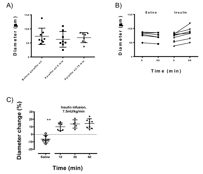 Vessel diameter changes chart; insulin infusion vs. saline comparison; statistical analysis.