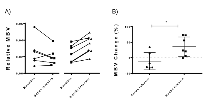 relative MBV chart showing saline vs. insulin infusion, MBV change percentage analysis.