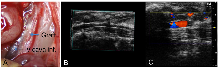 figure-results-2 Graft integration process; surgical, ultrasound, and Doppler images of vascular procedure analysis.