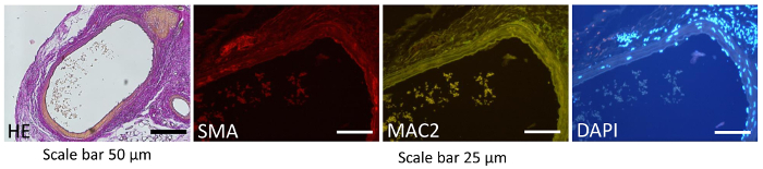 figure-results-3 Histology and immunofluorescence images with HE, SMA, MAC2, and DAPI staining, scale bar 25-50 µm.