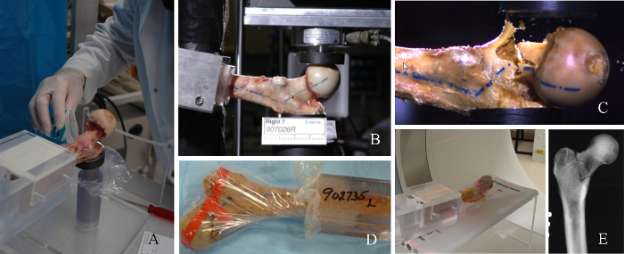 Bone testing setup; mechanical stress analysis on human femur; experimental procedure and X-ray.