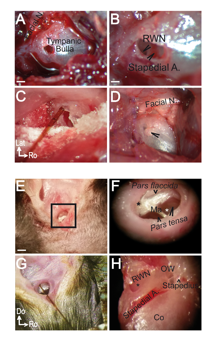 Microscopic images of ear anatomy, showing facial nerve, tympanic bulla, stapedial artery.
