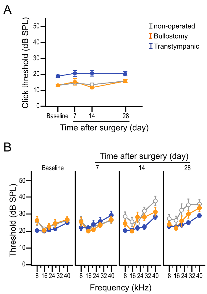 Hearing threshold graph showing post-surgery auditory recovery over time at varied frequencies.