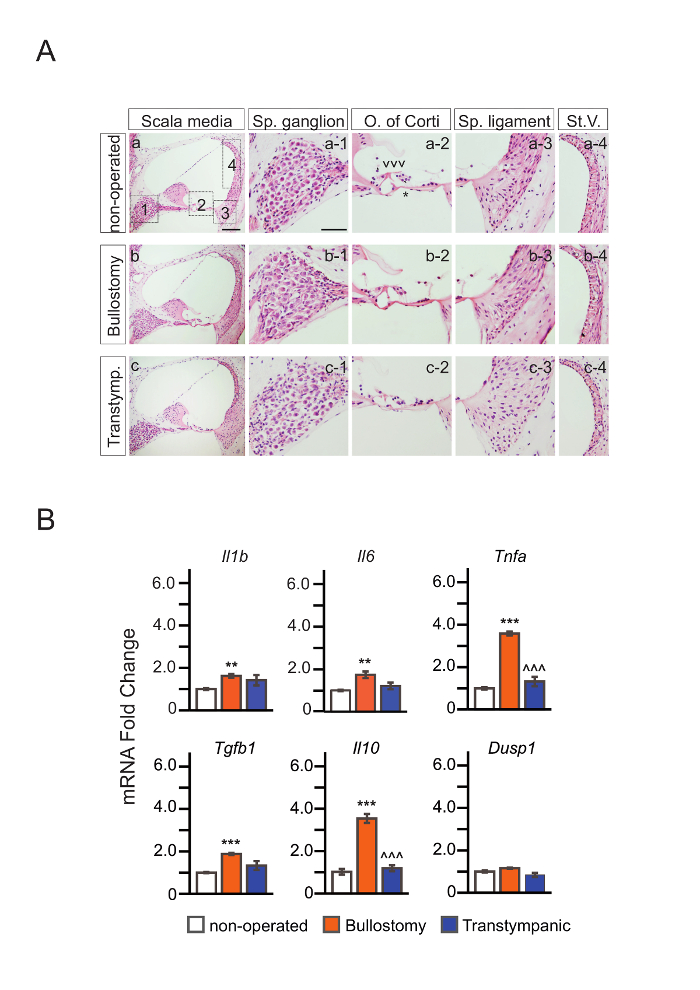 Histological diagram of cochlea and bar charts of mRNA expression comparing surgical methods.