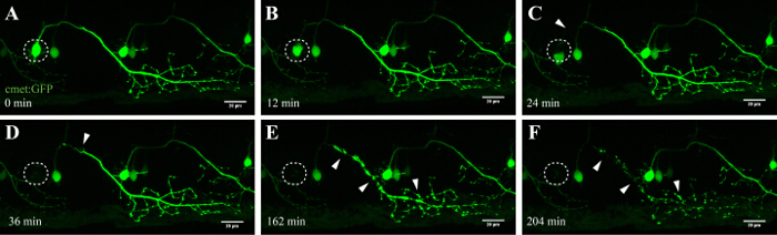 Time-lapse microscopy chart showing neuron growth with GFP labeling over 204 minutes.