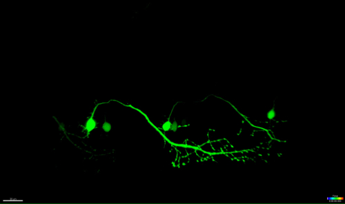Neuronal cells; fluorescence microscopy image; green fluorescence highlights dendritic structures.