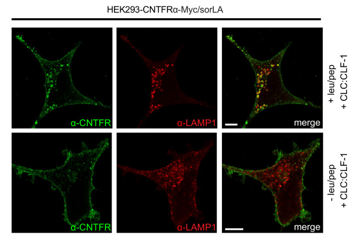 Fluorescence microscopy of HEK293 cells; α-CNTFR and α-LAMP1 markers; colocalization analysis.