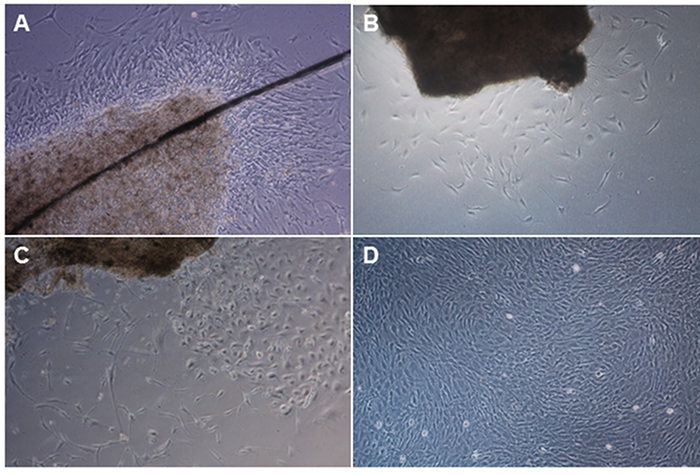 Cell culture microscopy; fibroblast proliferation; four-panel comparison; biological research.
