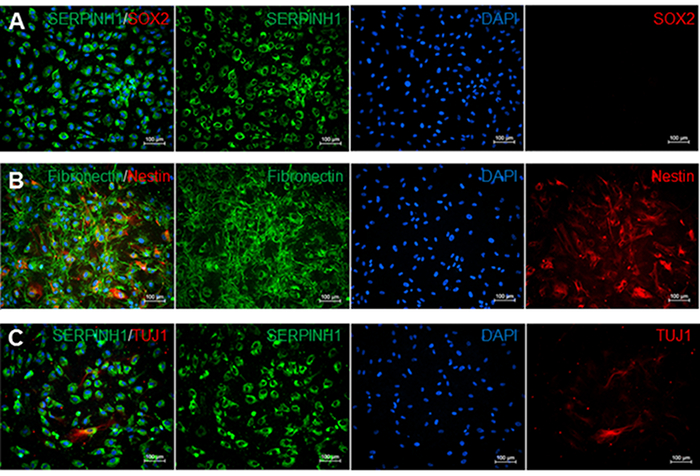 Immunofluorescence microscopy of cell markers SERPINH1, SOX2, Nestin, TUJ1; protein expression.