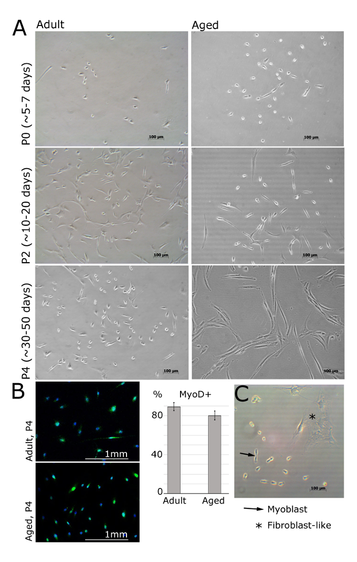 Cellular aging microscopy; adult vs. aged cells, phase contrast, immunofluorescence, MyoD analysis.